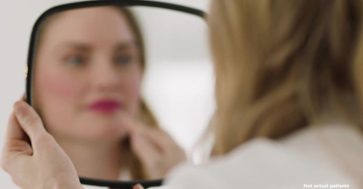 Lip Fillers